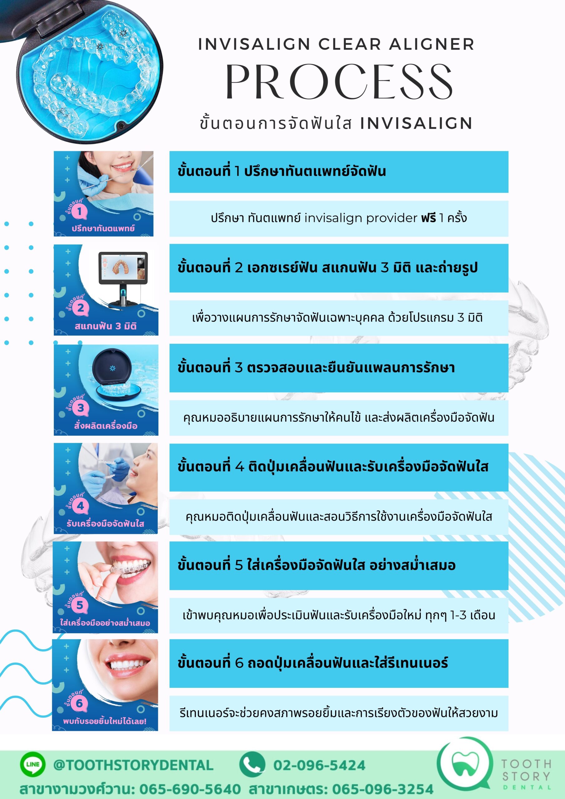 จัดฟันใส invisalign – Tooth Story Dental Clinic